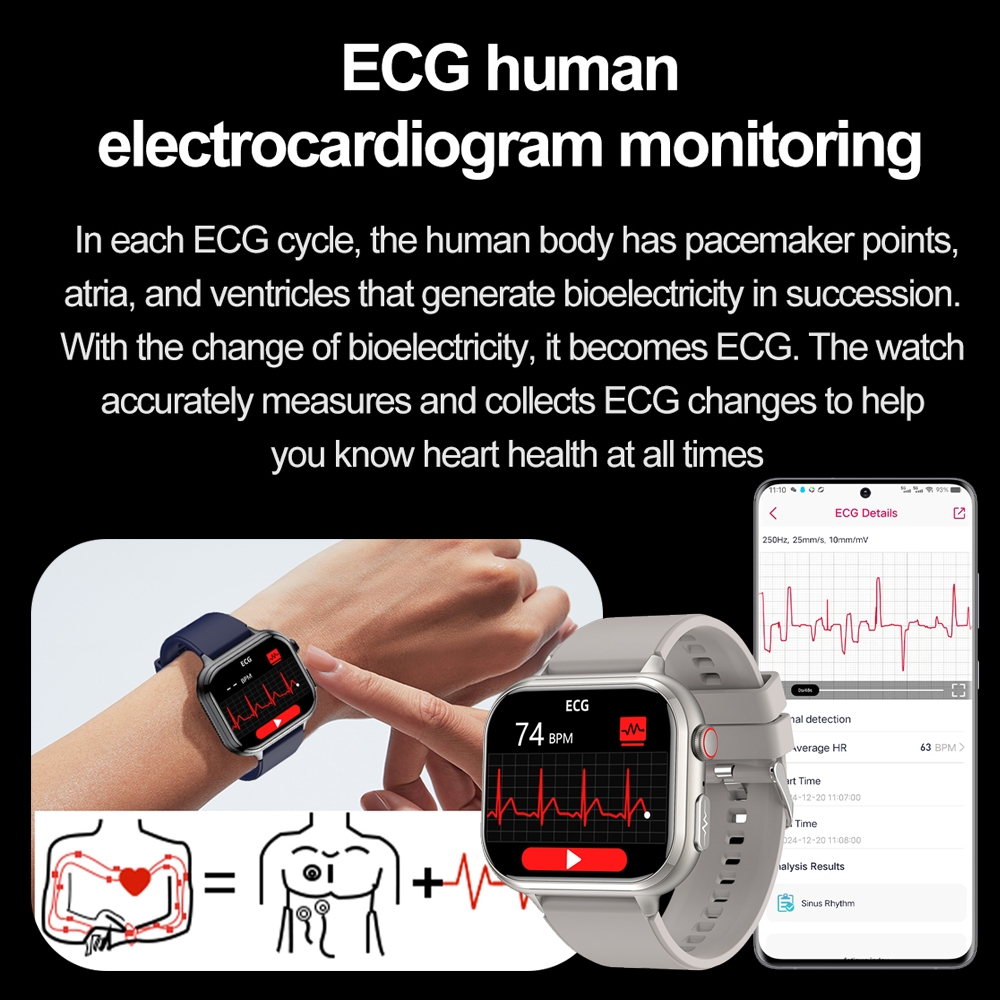 2026 새로운 건강 분석 스마트 시계 요산 혈액 지질 - Smartwatch Health Watches For Women 리뷰 및 가격